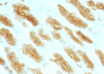 Basic Cytokeratin Antibody