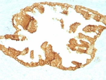 Basic Cytokeratin Antibody