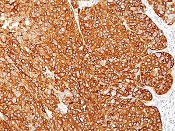 Melanoma Cell Marker Antibody Cocktail