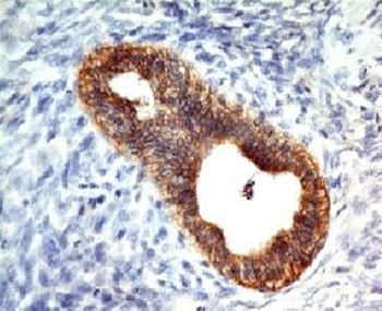 E-Cadherin Antibody / CDH1