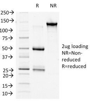 b-Catenin Antibody