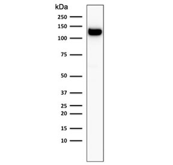 E-Cadherin Antibody