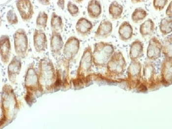 Beta Catenin Antibody