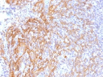 b-Catenin Antibody