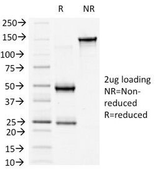 b-Catenin Antibody