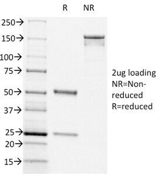 CD44v6 Antibody