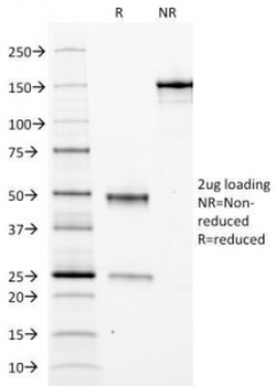 Ferritin Light Chain Antibody