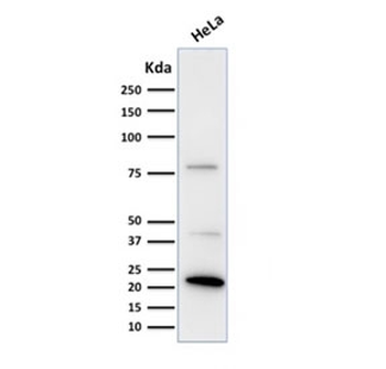 Ferritin Light Chain Antibody