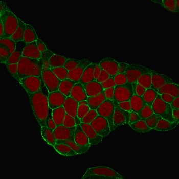 EpCAM Antibody / Extracellular domain