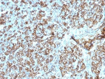 HLA-DP/DQ/DR Antibody (MHC II)