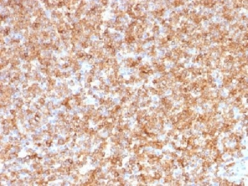 HLA-DP/DQ/DR Antibody (MHC II)