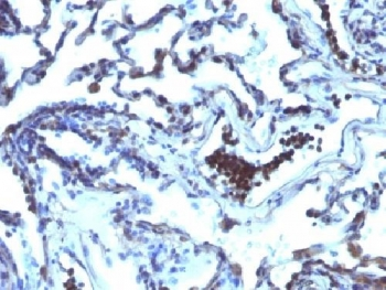 TDP2 Antibody / Tyrosyl-DNA phosphodiesterase 2 / ETS1 associated protein II