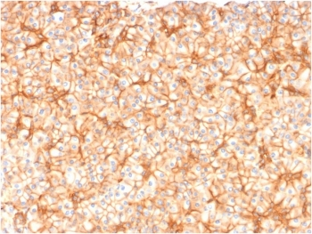 Spectrin beta III Antibody / SPTBN2