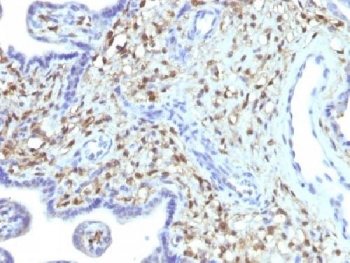 FSP1 Antibody / S100A4