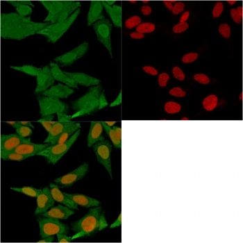 FSP1 Antibody / S100A4
