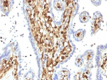 S100A4 Antibody / FSP1