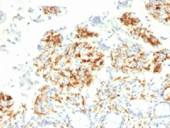 DC-SIGN Antibody / CD209