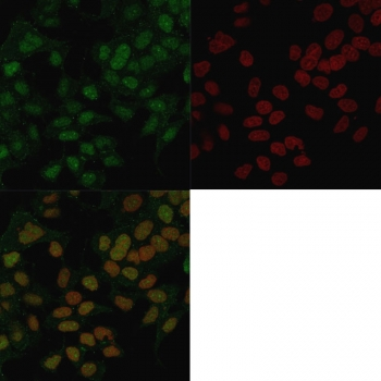 FOXA1 Antibody