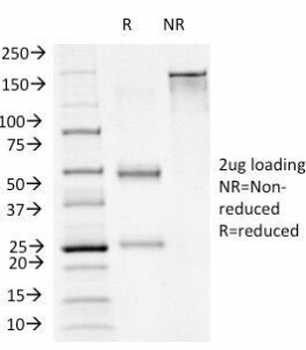 FOXA1 Antibody