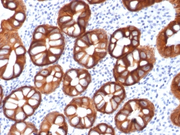 Recombinant EpCAM Antibody