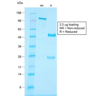 Recombinant CD34 Antibody / Rabbit Monoclonal