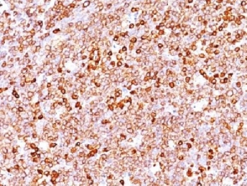 Recombinant CD79a Antibody / Rabbit Monoclonal