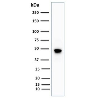 Recombinant CD79a Antibody / Rabbit Monoclonal