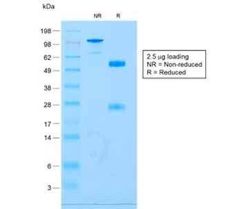 Recombinant CD79a Antibody / Rabbit Monoclonal