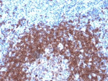 Recombinant CD79a Antibody / Rabbit Monoclonal