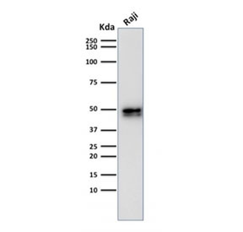 Recombinant CD79a Antibody / Rabbit Monoclonal