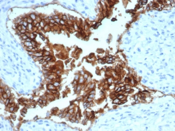 EpCAM Antibody / Extracellular domain