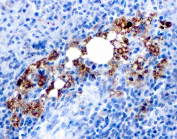 Recombinant TRAcP Antibody / TRAP / ACP5