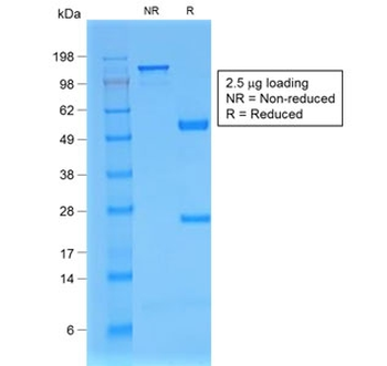 Recombinant Beta-2 Microglobulin Antibody