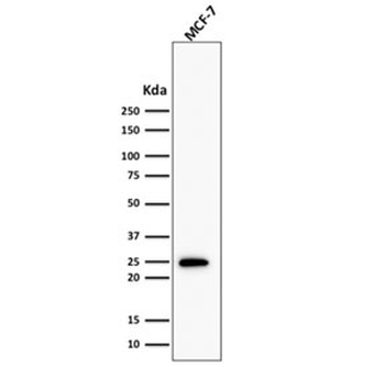 Recombinant Bcl2 Antibody / Rabbit Monoclonal