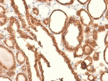 Recombinant EpCAM Antibody / Extracellular domain