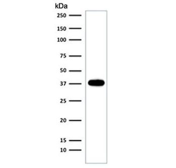 Recombinant EpCAM Antibody / Extracellular domain