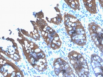 Recombinant CK8 Antibody / Cytokeratin 8