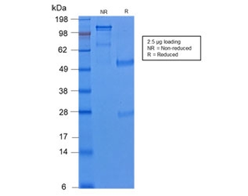 Recombinant Cytokeratin 8 Antibody / Rabbit Monoclonal