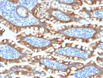 Recombinant Cytokeratin 8 Antibody / Rabbit Monoclonal