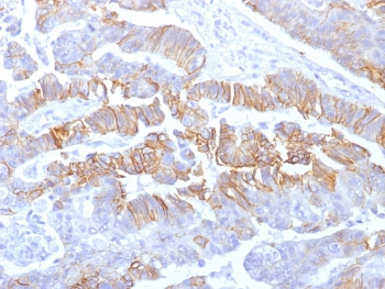 Recombinant E-Cadherin Antibody