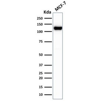 Recombinant E-Cadherin Antibody