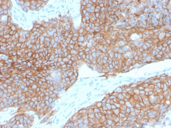 Recombinant E-Cadherin Antibody / Rabbit Monoclonal