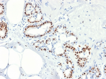 Recombinant Estrogen Receptor alpha Antibody