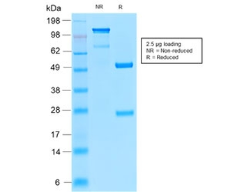Recombinant TRP1 Antibody / Tyrosinase Related Protein 1 / TYRP1