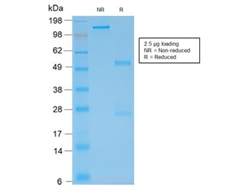 Recombinant Glial Fibrillary Acidic Protein Antibody