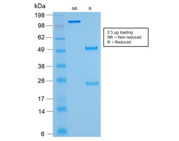 Recombinant Kappa Antibody