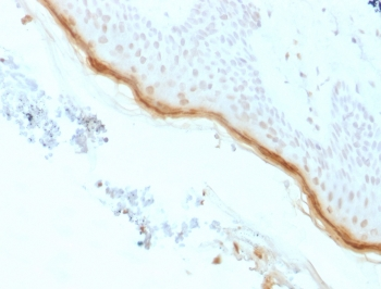 Recombinant Filaggrin Antibody