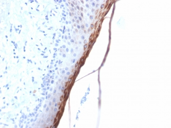 Recombinant FLG Antibody / Filaggrin