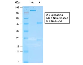 Recombinant CK19 Antibody / Cytokeratin 19