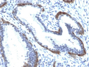 Recombinant Cytokeratin 15 Antibody / Rabbit Monoclonal